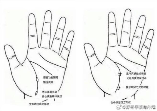 生命线攻略难点在哪？高玩教你轻松过关！